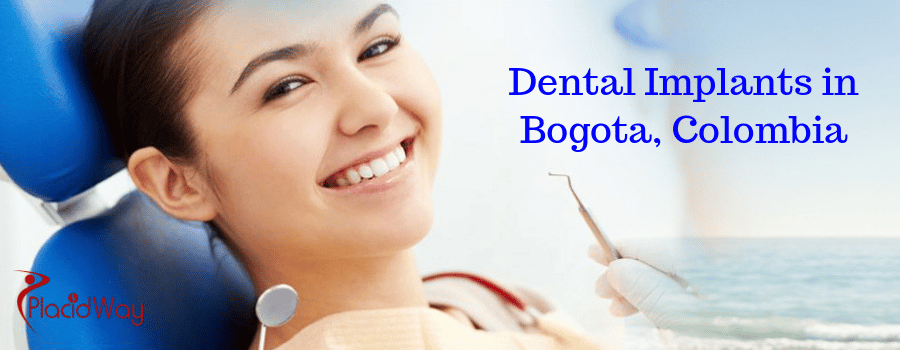 Dental Implants in Bogota, Colombia